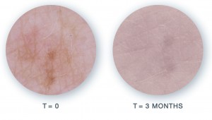 LighteningOneFoldv03inside