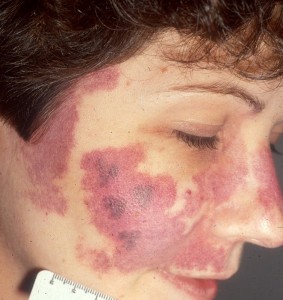 551359_539823422717626_1713169438_n